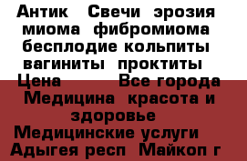 Антик.  Свечи (эрозия, миома, фибромиома, бесплодие,кольпиты, вагиниты, проктиты › Цена ­ 550 - Все города Медицина, красота и здоровье » Медицинские услуги   . Адыгея респ.,Майкоп г.